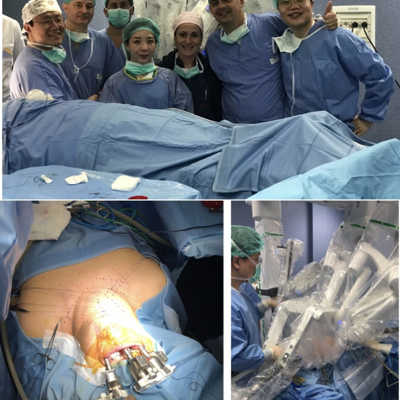 Eseguita al Policlinico di Messina la prima tiroidectomia transorale robotica in Europa.