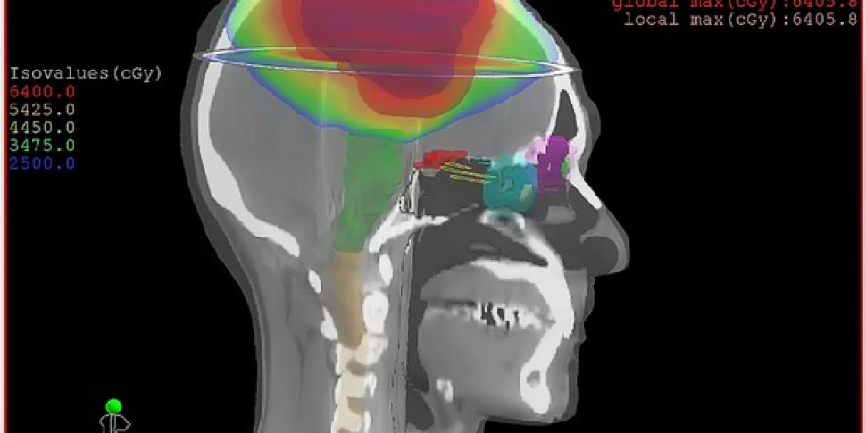 I ricercatori bloccano un tumore maligno cerebrale infantile prima che si formi