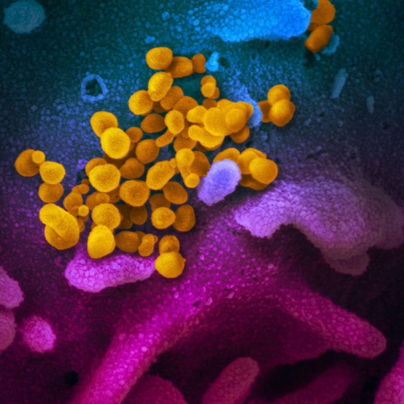 Particelle del coronavirus SarsCov2 sulla superficie di una cellula, ottenute dal Niaid (fonte: NIAID-RML)