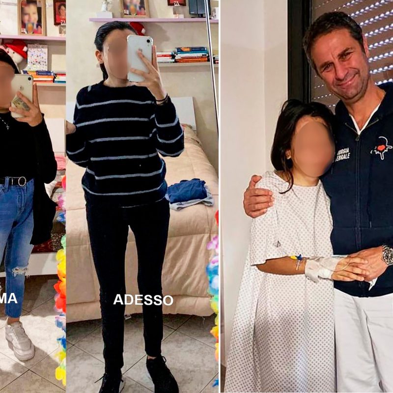 La ragazza operata con il chirurgo Alessandro Gasbarrini