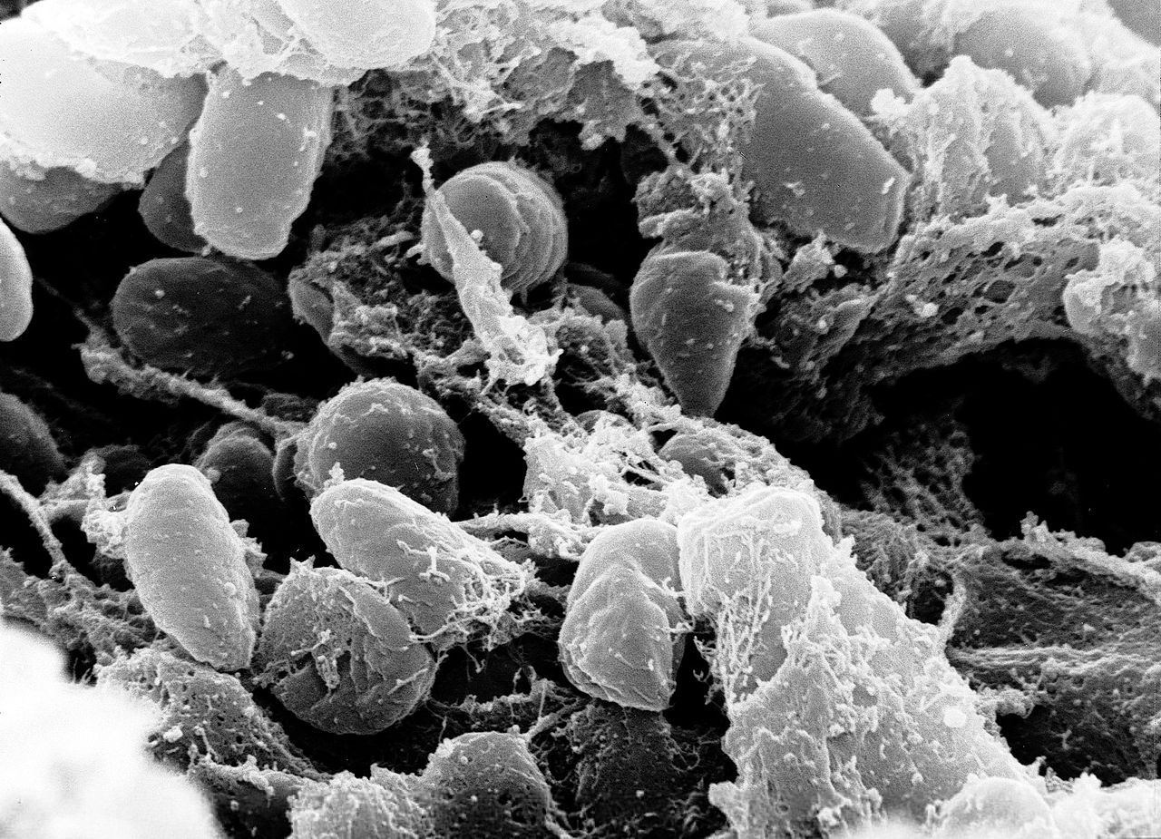 Rarissimo caso di peste bubbonica, uomo contagiato dal suo gatto in… Rarissimo caso di peste bubbonica, uomo contagiato dal suo gatto in…