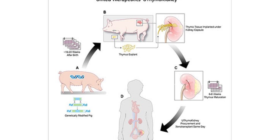 Ok negli Usa alla sperimentazione del trapianto di rene maiale uomo. In Italia un progetto sugli organi modificati