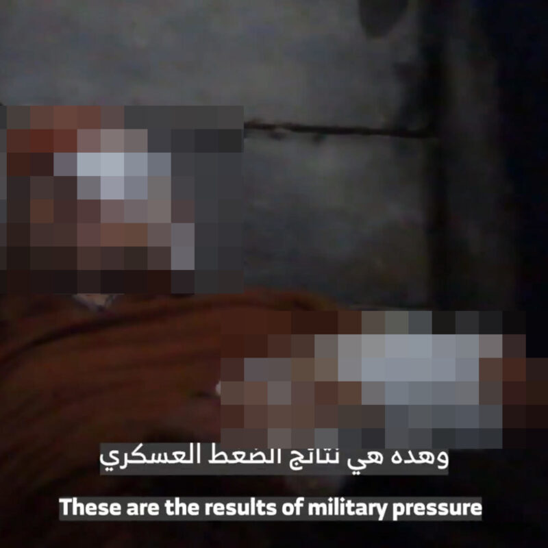 +++ EDITORS NOTE: Graphic content +++Un fermo immagine del video diffuso da Hamas in cui si vede l'ostaggio Maxim Harkin, ferito, fasciato, insanguinato, apparentemente raggiunto dai miliziani in un tunnel ostruito da terra e detriti. Il giovane parla con fatica, con la testa e un occhio bendati, un braccio ferito.ANSA/FERMO IMMAGINE VIDEO HAMAS+++ ATTENZIONE LA FOTO NON PUO' ESSERE PUBBLICATA O RIPRODOTTA SENZA L'AUTORIZZAZIONE DELLA FONTE DI ORIGINE CUI SI RINVIA+++ NPK +++