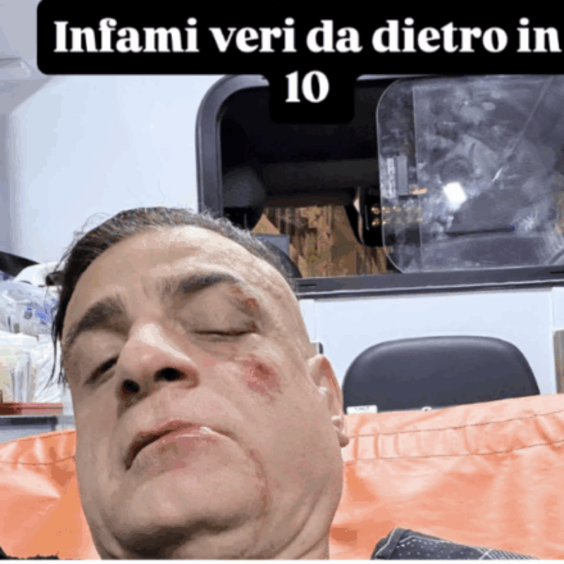 L'eroe anti-borseggiatori Cicalone pestato a sangue: “Erano in dieci e mi hanno preso alle spalle”