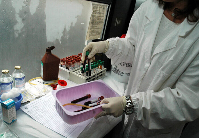 in aumento i casi di epatite a in italia sotto osservazione anche il nord della calabria il maltempo tra le possibili cause da Feedpress.me in aumento i casi di epatite a in italia sotto osservazione anche il nord della calabria il maltempo tra le possibili cause