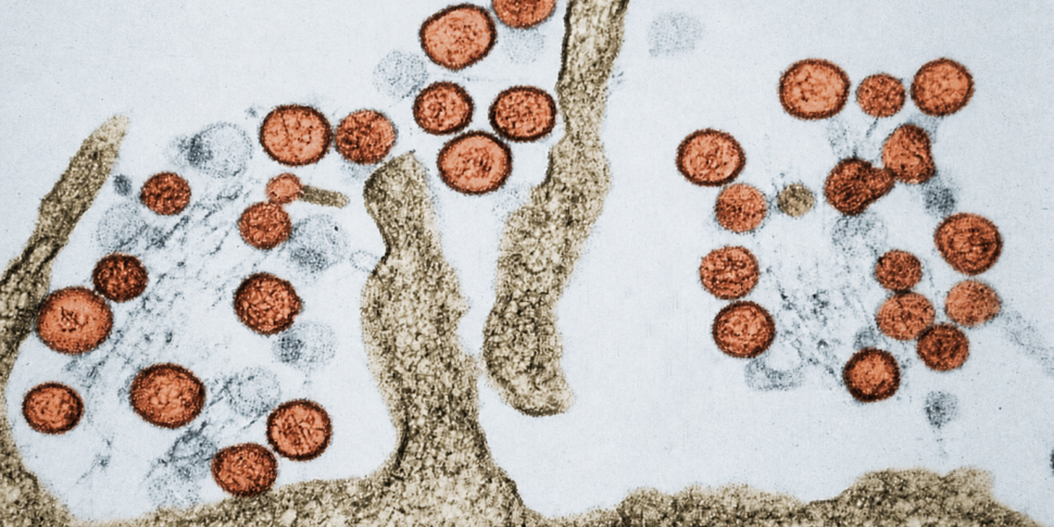 https://assets.gazzettadelsud.it/2026/05/Hantavirus-970x485.png