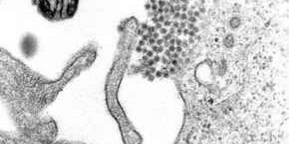 due casi di virus dengue a udine e livorno al via la disinfestazione da Gazzettadelsud.it due casi di virus dengue a udine e livorno al via la disinfestazione
